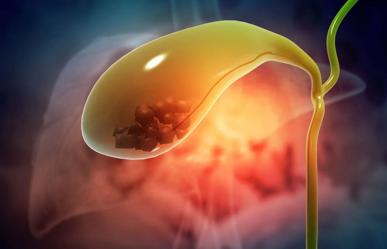 Contracted Gall Bladder Treatment & Symptoms | Lopmudra Hospital General Surgery
