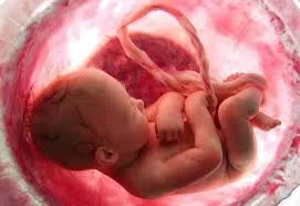 Low Lying Placenta: Symptoms, Risks & Treatment in Gynaecology at Lopmudra Hospital