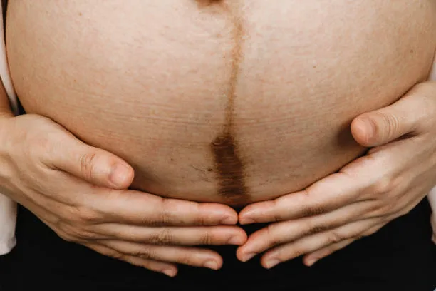 Managing C-Section Regret: Expert Tips from Lopmudra Hospital for a Healthier Recovery